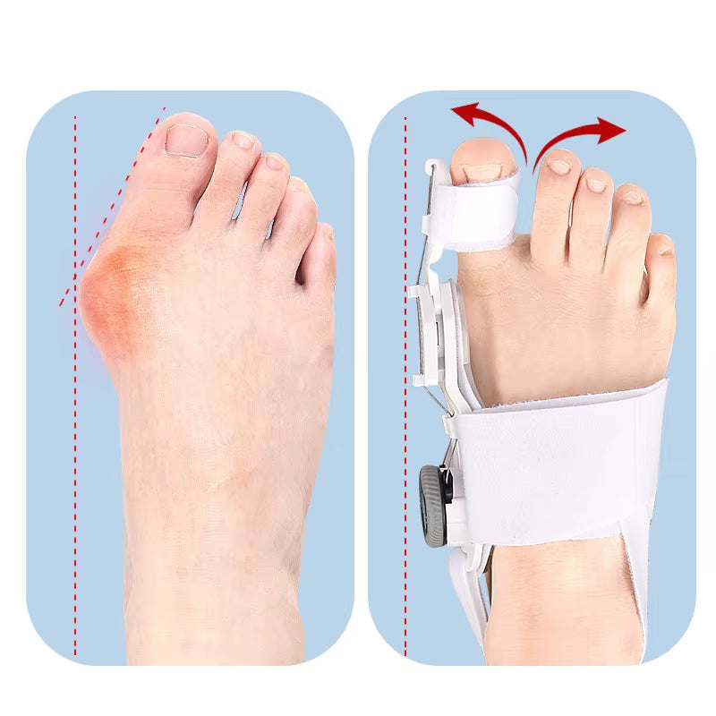 1PC Bunion Corrector Unisex Foot Hallux Valgus Braces Rotatable Toe Separator Straightener Adjustable Finger Toe Corrector